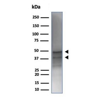 Recombinant GATA Binding Protein 3 Antibody / GATA-3
