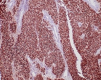 Recombinant GATA Binding Protein 3 Antibody / GATA-3