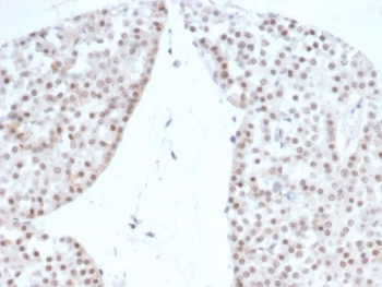 Recombinant Steroidogenic Factor 1 Antibody