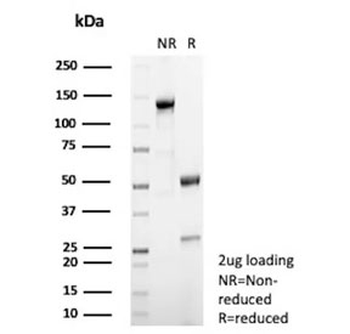 Recombinant Steroidogenic Factor 1 Antibody