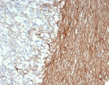 GFAP Antibody / Glial Fibrillary Acidic Protein