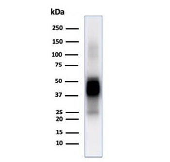 GFAP Antibody / Glial Fibrillary Acidic Protein