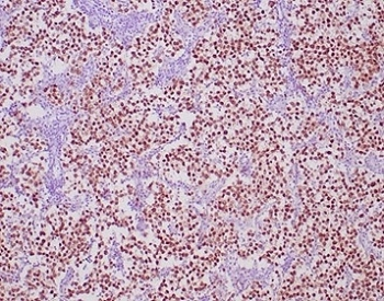 POU5F1 Antibody / OCT4