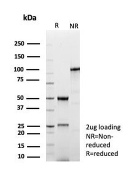 Dystrophin Antibody / DMD