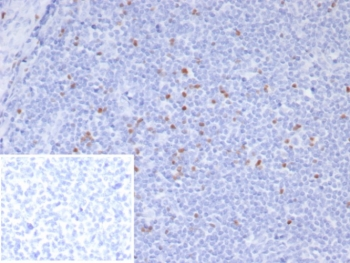 Scurfin Antibody / FOXP3