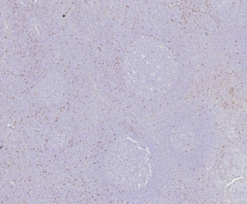 Scurfin Antibody / FOXP3