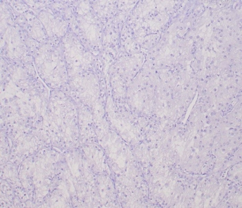 TFE3 Antibody / Transcription factor E3