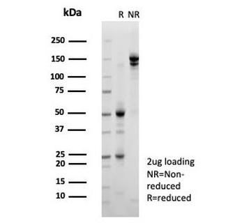 JARID1C Antibody / KDM5C / SMCX