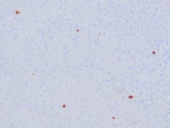 Herpes Simplex Virus Type I Antibody / HSV1