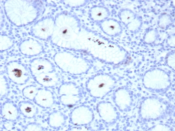 Helicobacter pylori Antibody (Catalase) / H. pylori