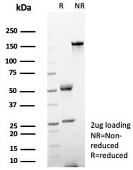 Helicobacter pylori Antibody (Catalase) / H. pylori