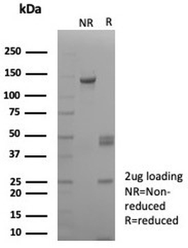 Biotin Antibody