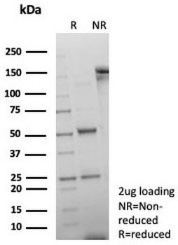 Double Stranded DNA Antibody / dsDNA
