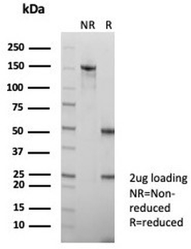 HBsAg Antibody / Hepatitis B surface antigen