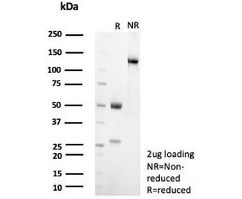 SF-1 Antibody / Steroidogenic Factor 1 / NR5A1