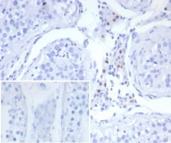 SF-1 Antibody / Steroidogenic Factor 1 / NR5A1