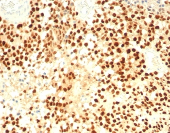 Steroidogenic Factor 1 Antibody / SF-1 / R5A1
