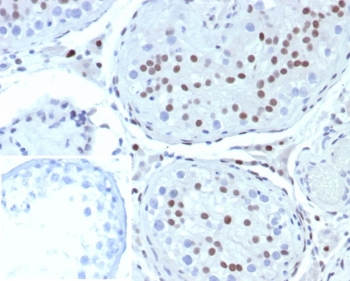 Steroidogenic Factor 1 Antibody / SF-1 / R5A1