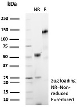 TNFSF15 Antibody / VEGI / TL1A