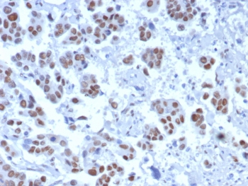 Transducin-like enhancer protein 1 Antibody / TLE1