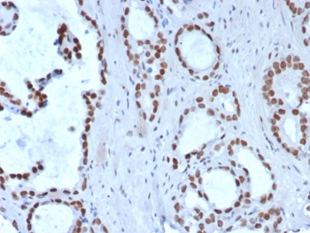 Transducin-like enhancer protein 1 Antibody / TLE1