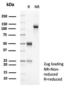 Tyrosinase-Related Protein-1 Antibody / TYRP1