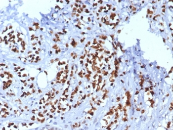 TRPS1 Antibody / Tricho-rhino-phalangeal syndrome type I