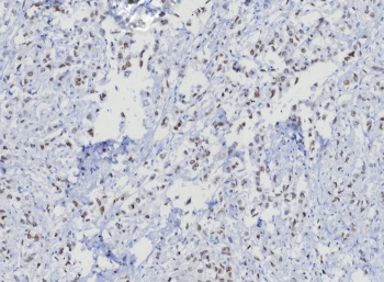 TRPS1 Antibody / Tricho-rhino-phalangeal syndrome type I