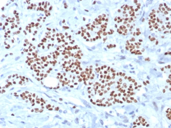 TRPS1 Antibody / Tricho-rhino-phalangeal syndrome type I