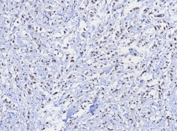 TRPS1 Antibody / Tricho-rhino-phalangeal syndrome type I