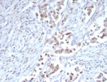 Tricho-rhino-phalangeal syndrome type I Antibody / TRPS1