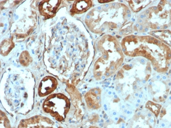 CALB1 Antibody / Calbindin 1