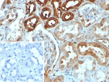 CALB1 Antibody / Calbindin 1
