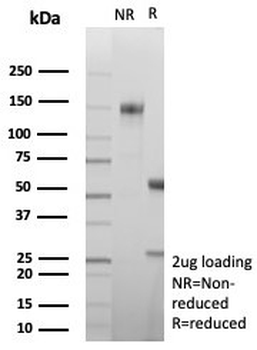 Carbonic Anhydrase VIII Antibody / CA8