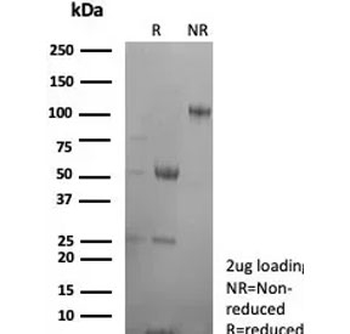 CA8 Antibody / Carbonic Anhydrase VIII