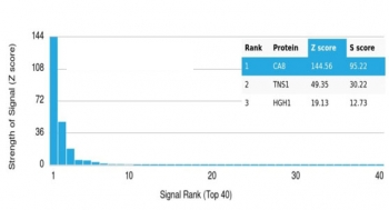 Carbonic Anhydrase VIII Antibody / CA8