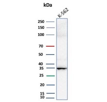 Carbonic Anhydrase VIII Antibody / CA8