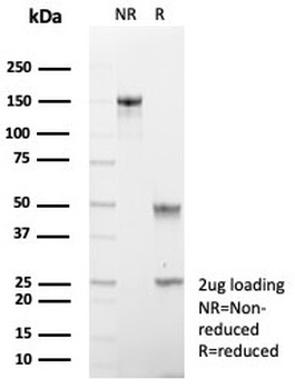 Cadherin 17 Antibody / CDH17