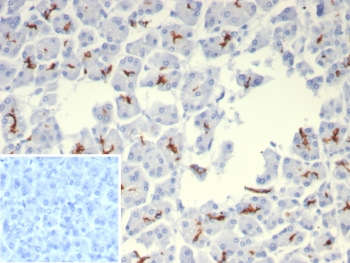 Cystic Fibrosis Transmembrane Regulator Antibody / CFTR