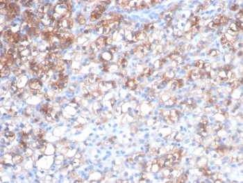 HSPB1 Antibody / HSP70