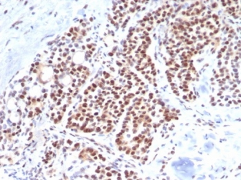 TBXT Antibody / Brachyury / Protein T