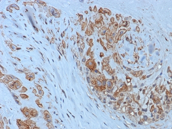 HLA-G Antibody