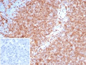Pan-HLA-II Antibody / HLA-DP/DQ/DR