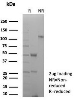 Pan-HLA Antibody / HLA-DP/DQ/DR