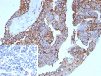Pan-HLA Antibody / HLA-DP/DQ/DR