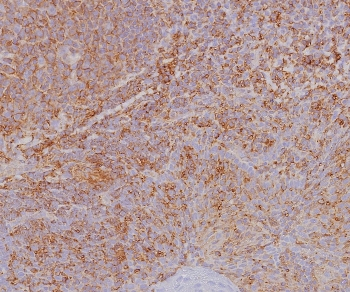 HLA-ABC Antibody / MHC I