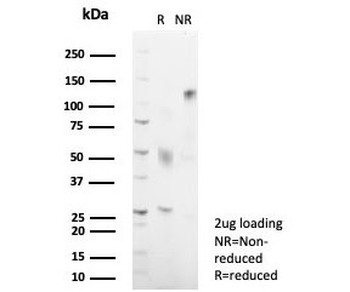 HLA-DRB Antibody