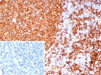 HLA-DRB Antibody