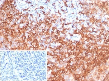 HLA-DRB Antibody