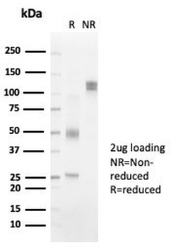 HLA-DRB Antibody